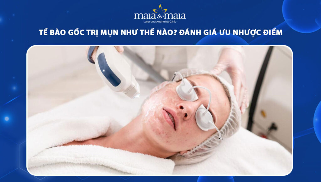 Tế bào gốc trị mụn như thế nào? Đánh giá ưu nhược điểm 1 tế bào gốc trị mụn