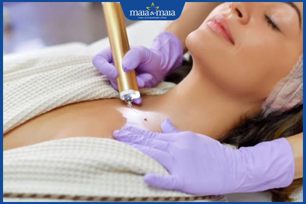 thực hiện xăm nốt ruồi phong thủy