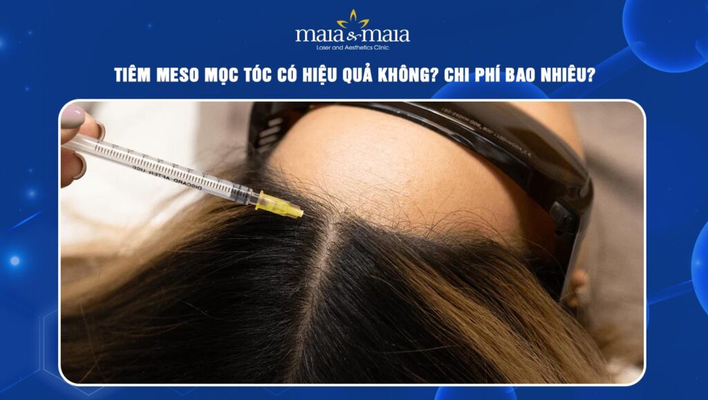 tiêm meso mọc tóc