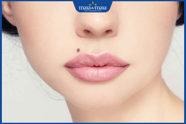 tướng nốt ruồi lệch ở nhân trung