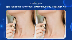 ứng dụng tẩy nốt ruồi