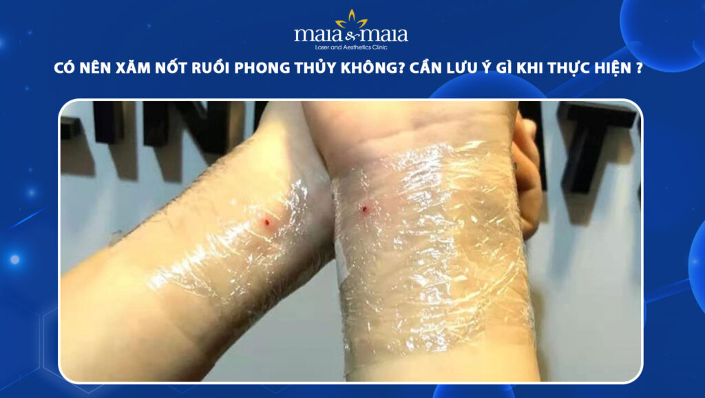 xăm nốt ruồi phong thủy