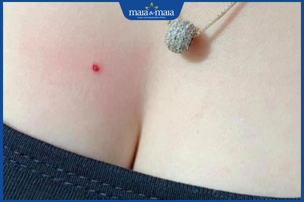 xăm nốt ruồi phong thủy ở ngực