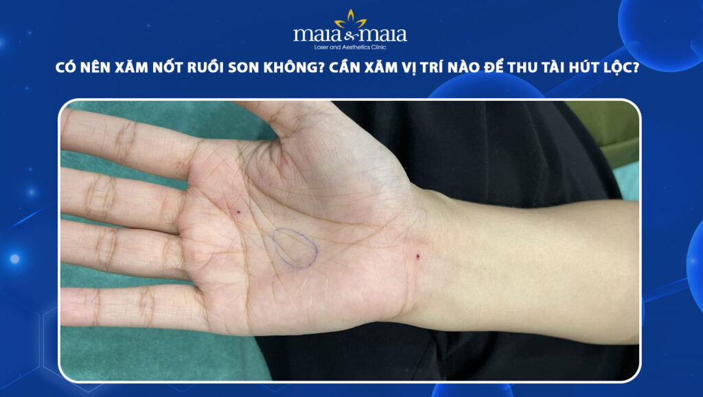 xăm nốt ruồi son