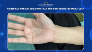 xăm nốt ruồi son