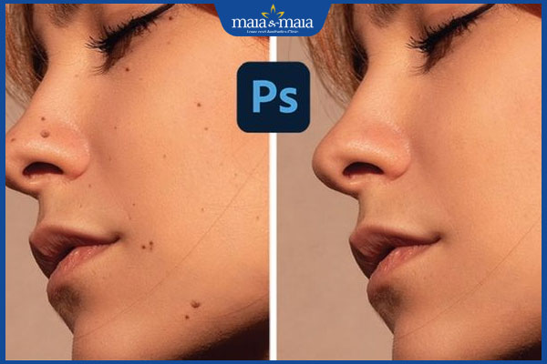 xóa nốt ruồi bằng photoshop