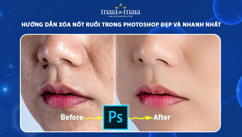 xóa nốt ruồi trong photoshop