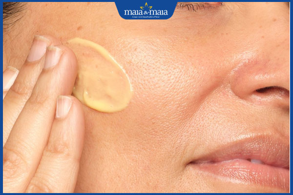 Tổng hợp các cách trị vết thâm muỗi đốt hiệu quả và an toàn 2 bôi kem nghệ