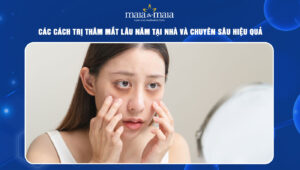 cách trị thâm mắt lâu năm