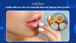 cách trị thâm môi bằng mỡ trăn