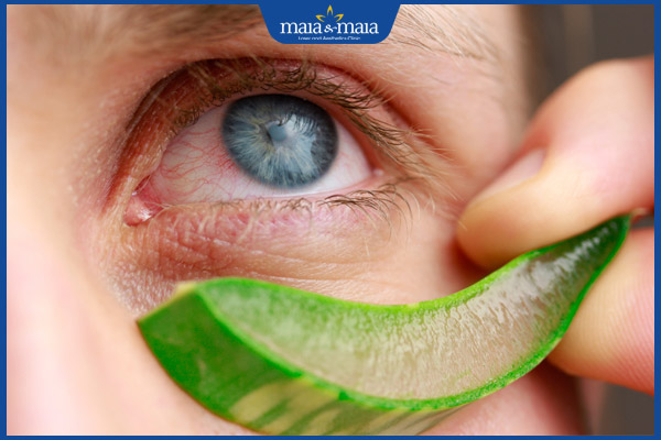 Mách bạn 6 cách trị thâm mắt bằng nha đam không nên bỏ qua 2 đắp nha đam tươi