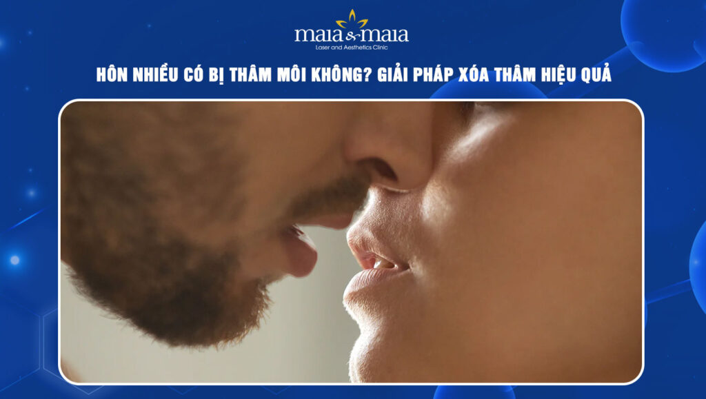 hôn nhiều có bị thâm môi không