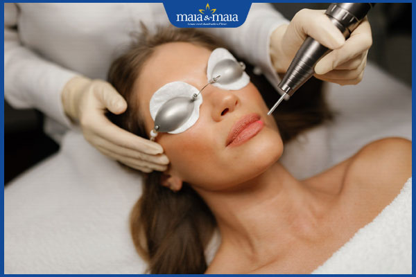 Tổng hợp 5 địa chỉ khử thâm môi uy tín, chất lượng 2 khử thâm môi bằng laser