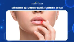 khử thâm môi có đau không
