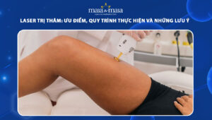 laser trị thâm