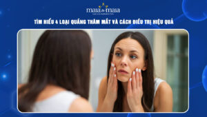 loại quầng thâm mắt