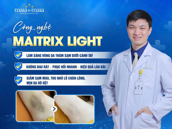 Bật mí 5 mẹo trị thâm nách bằng khoai tây an toàn tại nhà 6 maitrix light trị thâm các vùng