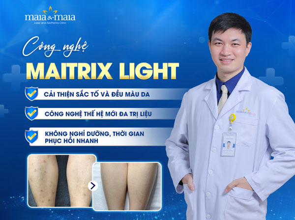 Top 5 cách trị thâm đầu gối bằng baking soda tại nhà 5 maitrix light trị vết thâm