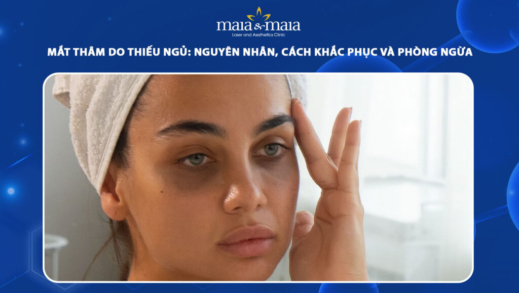 mắt thâm do thiếu ngủ