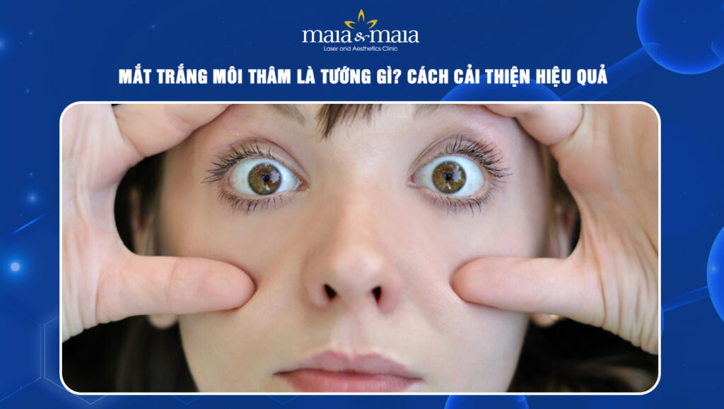 Mắt trắng môi thâm là tướng gì? Cách cải thiện hiệu quả 1 Mắt trắng môi thâm