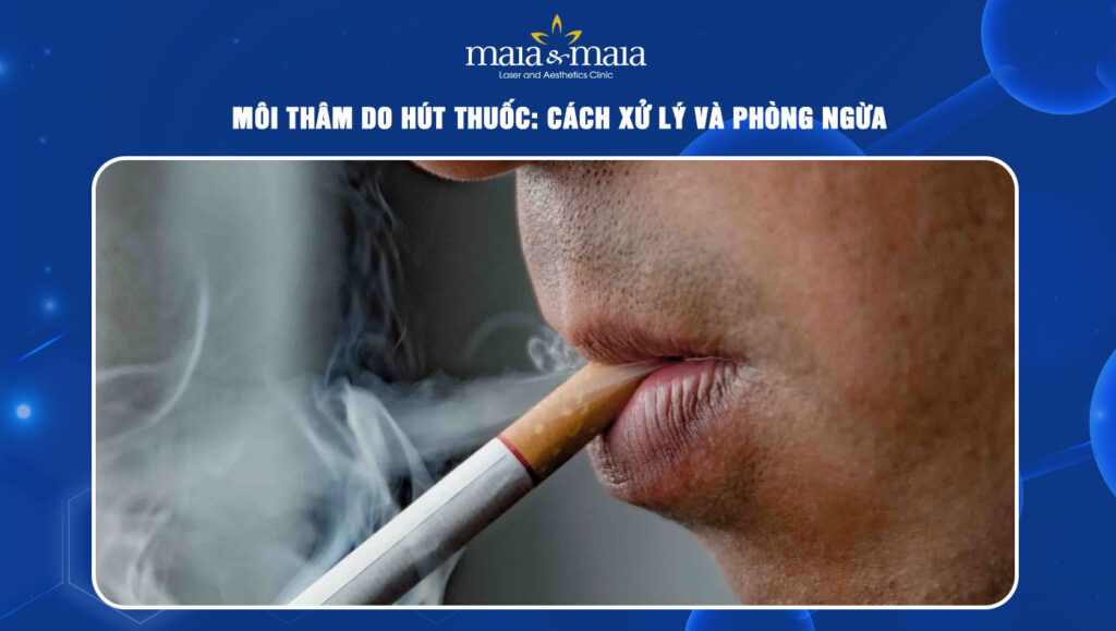 môi thâm do hút thuốc