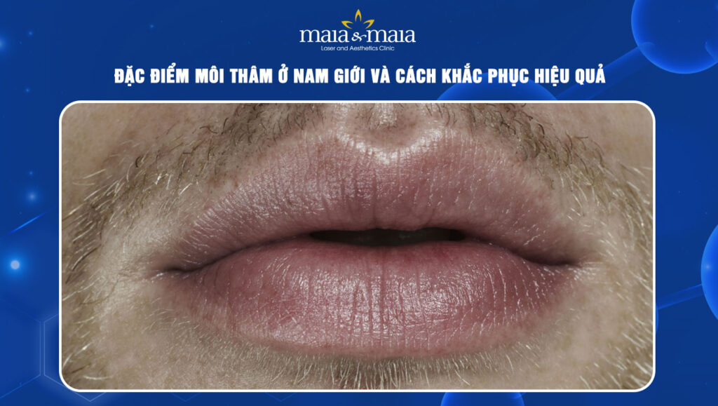 môi thâm ở nam giới