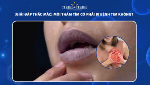 môi thâm tím có phải bị bệnh tim không