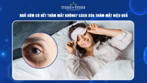 ngủ sớm có hết thâm mắt không