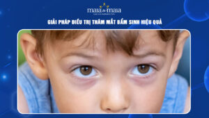 Thâm mắt bẩm sinh