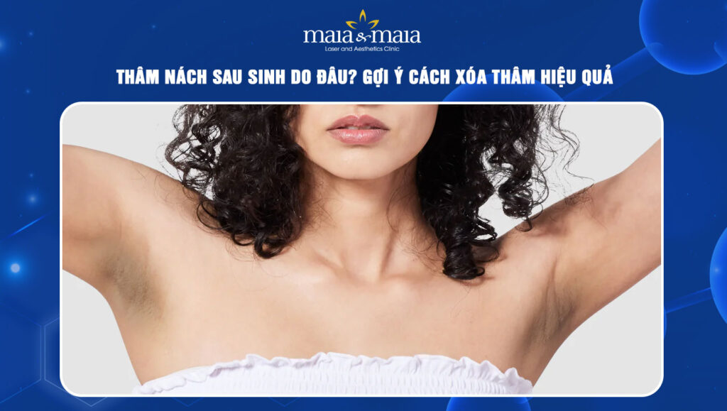 Thâm nách sau sinh do đâu? Gợi ý cách xóa thâm hiệu quả 1 thâm nách sau sinh