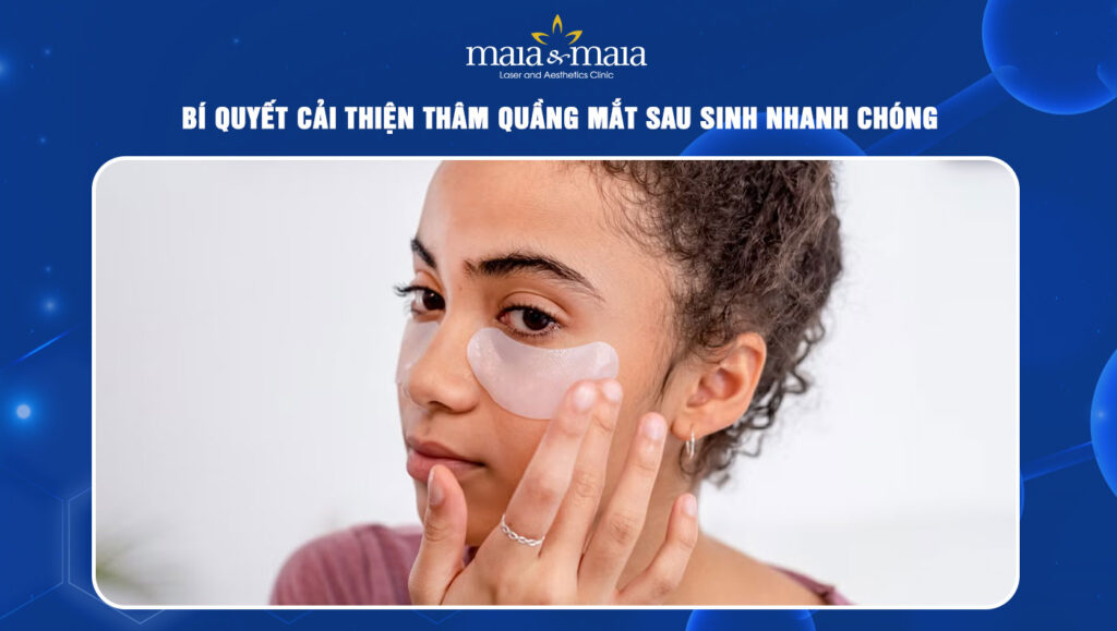 thâm quầng mắt sau sinh