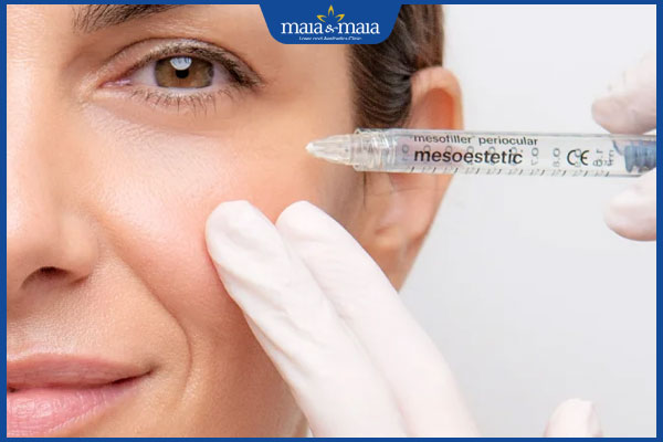 Tiêm meso trị thâm mắt có tốt không? Hiệu quả và lưu ý 5 tiêm meso giảm quầng thâm mắt