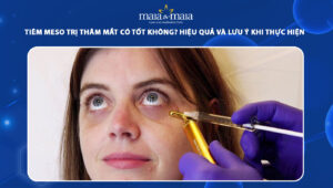tiêm meso trị thâm mắt