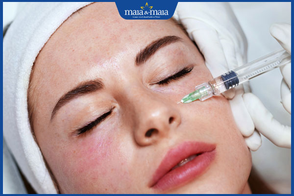 Tiêm meso trị thâm mắt có tốt không? Hiệu quả và lưu ý 3 tiêm trị quầng thâm mắt