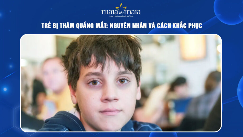 Trẻ bị thâm quầng mắt