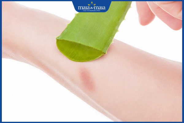 Giải pháp tân tiến xóa vết bỏng bị thâm đen hiệu quả cao 3 trị thâm do bỏng tại nhà