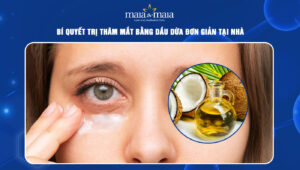 trị thâm mắt bằng dầu dừa