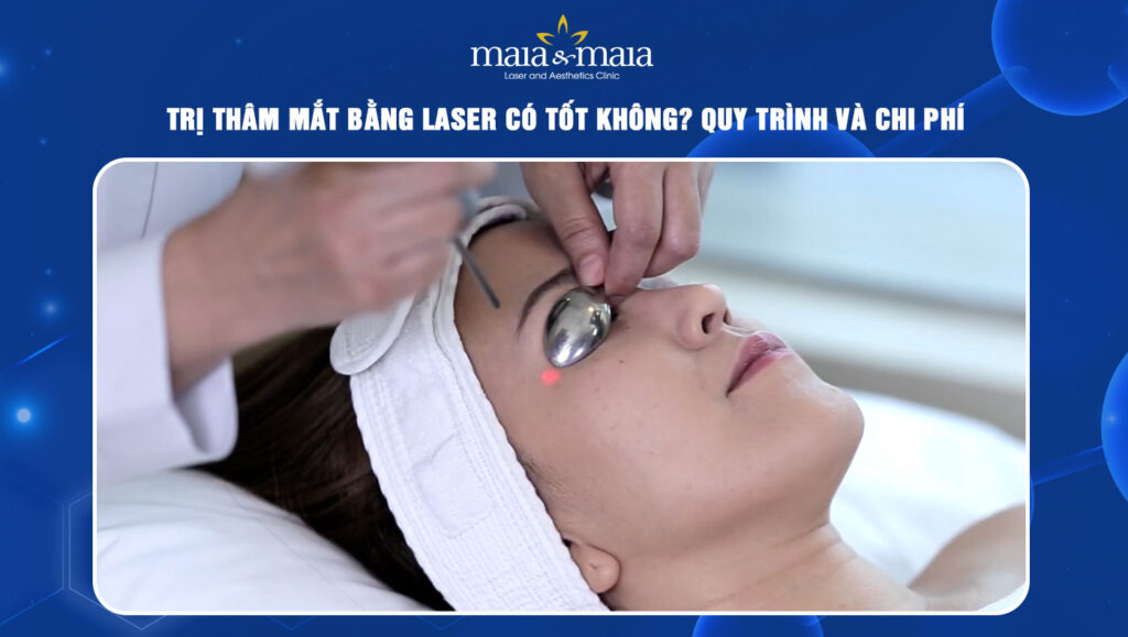 Trị thâm mắt bằng laser