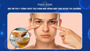 trị thâm mắt bằng mật ong