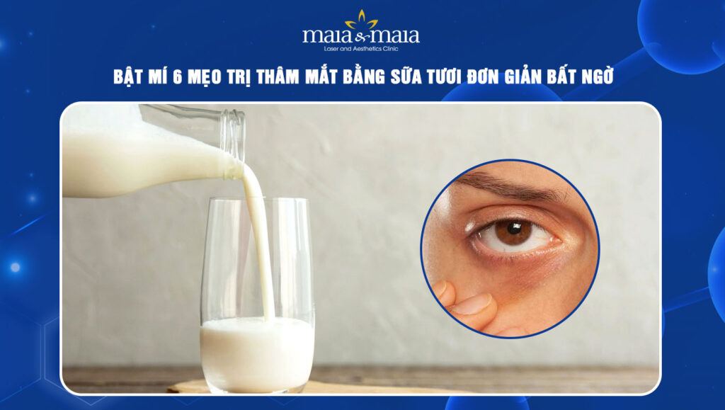 Bật mí 6 mẹo trị thâm mắt bằng sữa tươi đơn giản bất ngờ 1 Trị thâm mắt bằng sữa tươi