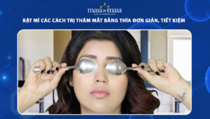 trị thâm mắt bằng thìa
