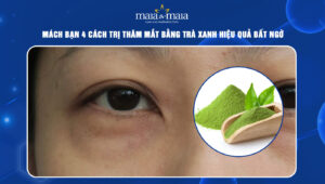 trị thâm mắt bằng trà xanh