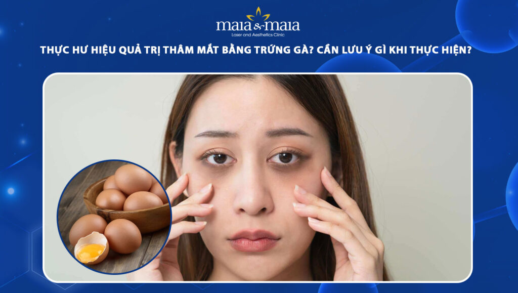 Thực hư hiệu quả trị thâm mắt bằng trứng gà? Cần lưu ý gì? 1 trị thâm mắt bằng trứng gà