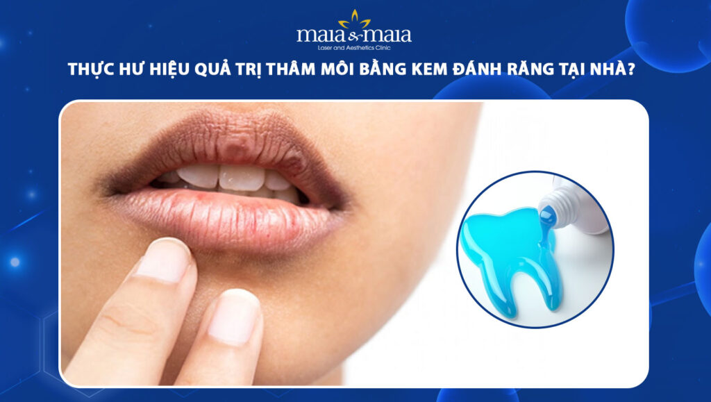 Thực hư hiệu quả trị thâm môi bằng kem đánh răng tại nhà? 1 trị thâm môi bằng kem đánh răng