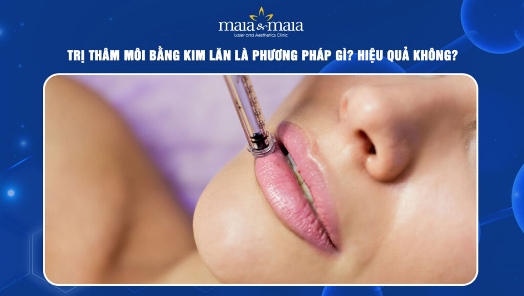 Trị thâm môi bằng kim lăn là phương pháp gì? Hiệu quả không? 1 Trị thâm môi bằng kim lăn
