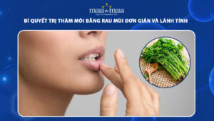 trị thâm môi bằng rau mùi