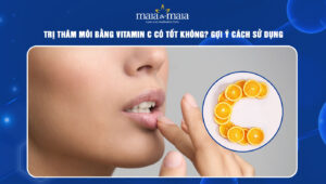 trị thâm môi bằng vitamin C