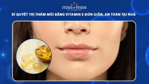 trị thâm môi bằng vitamin e