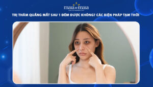 trị thâm quầng mắt sau 1 đêm