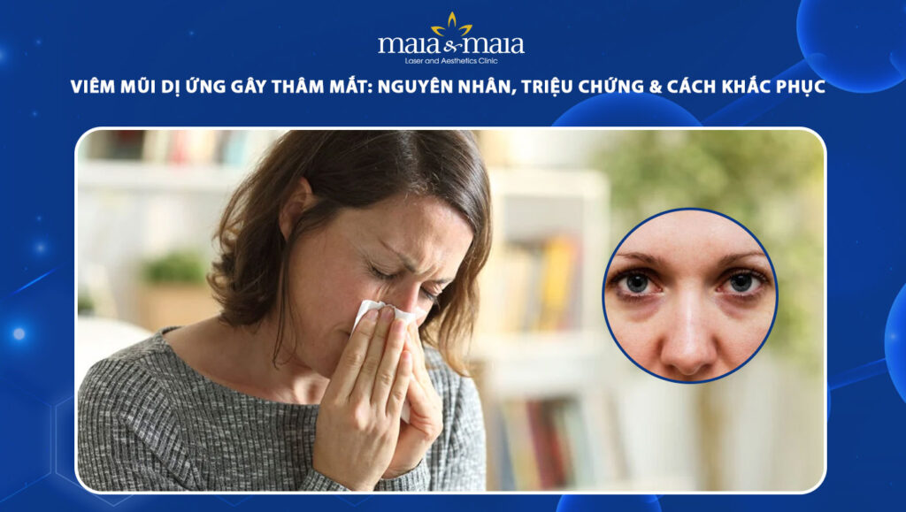 viêm mũi dị ứng gây thâm mắt